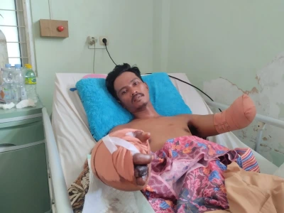Pembangunan KDMP di Kabupaten Seluma Telan Korban Hingga Tangan Diamputasi
